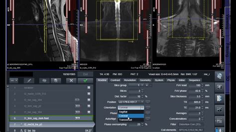 https://gws.cardmri.com|At A Glance – CARD MRI.